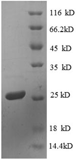 Recombinant E.Coli 30S Ribosomal Protein S4 (RPSD) Protein (His)