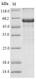 Recombinant Human Androgen Receptor (AR) Protein (His-SUMO&Myc)