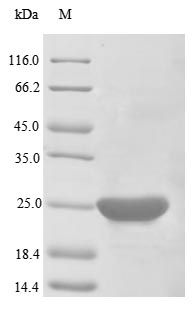 Recombinant Human Apoptosis Regulator Bcl-2 (BCL2) Protein (His)