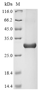 Recombinant Human Aryl Hydrocarbon Receptor (AHR) Protein (His)