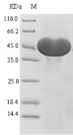 Recombinant Human Atp-Citrate Synthase (ACLY) Protein (His-SUMO)