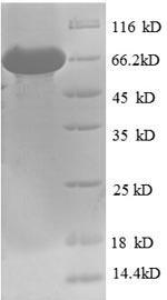 Recombinant Human Bile Acid Receptor (NR1H4) Protein (His-SUMO)