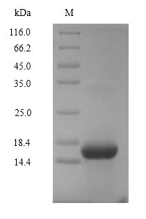 Recombinant Human Complement C5 (C5) Protein (His)