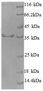 Recombinant Human Cyclin-Dependent Kinase 4 (CDK4) Protein (His)