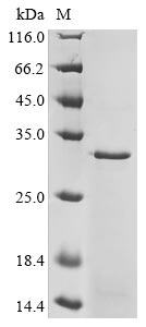 Recombinant Human D (DRD2) Protein (His&Myc)