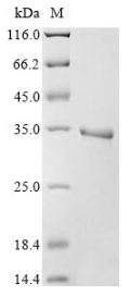 Recombinant Human Egl Nine Homolog 1 (EGLN1) Protein (His)