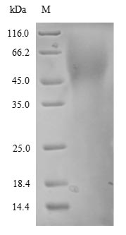 Recombinant Human Endothelin-1 Receptor (EDNRA) Protein (His)