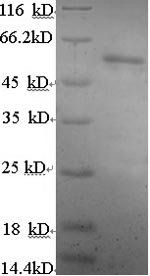 Recombinant Human Estrogen Receptor Beta (ESR2) Protein (His)