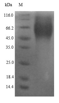 Recombinant Human Estrogen Receptor (ESR1) Protein (His)