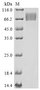 Recombinant Human Fibroblast Growth Factor Receptor 1 (FGFR1) Protein (His)