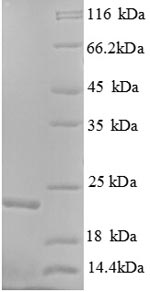 Recombinant Human Gtpase Kras (KRAS) Protein (His)