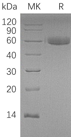 Recombinant Human HAO1 Protein (N-Trx-6His)