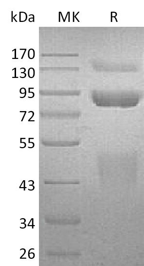 Recombinant Human HGF R Protein (C-6His)