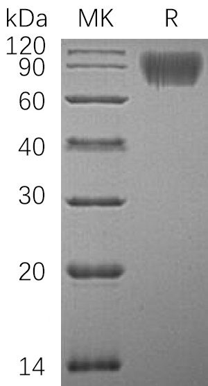 Recombinant Human ICAM-1 Protein (C-6His)