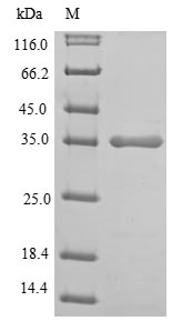 Recombinant Human L-Lactate Dehydrogenase A Chain (LDHA)