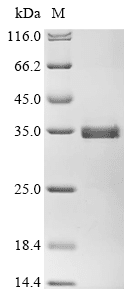 Recombinant Human Muscarinic Acetylcholine Receptor M2 (CHRM2) Protein (His)