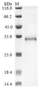 Recombinant Human Muscarinic Acetylcholine Receptor M3 (CHRM3) Protein (His)