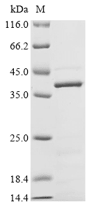 Recombinant Human Muscarinic Acetylcholine Receptor M5 (CHRM5) Protein (His)