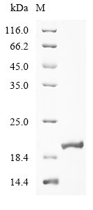 Recombinant Human Myosin-7 (MYH7) Protein (His)