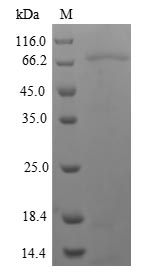 Recombinant Human Nuclear Receptor Subfamily 1 Group I Member 2 (NR1I2) Protein (His-SUMO&Myc)