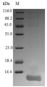 Recombinant Human Orexin Receptor Type 1 (HCRTR1) Protein (His&Myc)