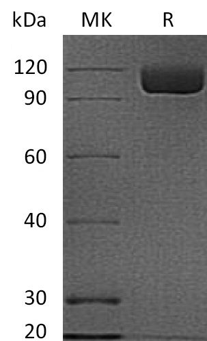 Recombinant Human PSMA Protein (N-6His)