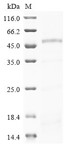Recombinant Human Phenylalanine-4-Hydroxylase (PAH)