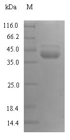 Recombinant Human Plasma Kallikrein (KLKB1) Protein (His)