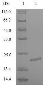 Recombinant Human Potassium Voltage-Gated Channel Subfamily A Member 1 (KCNA1) Protein (His)