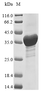 Recombinant Human Receptor Tyrosine-Protein Kinase Erbb-2 (ERBB2) Protein (His&Myc)