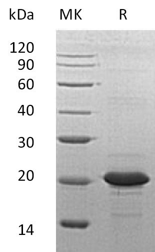 Recombinant Human SOD1 Protein (N-6His)