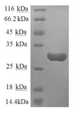Recombinant Human Substance-P Receptor (TACR1) Protein (GST)