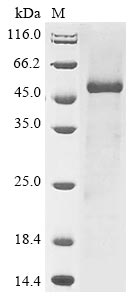 Recombinant Human Tubulin Beta Chain (TUBB) Protein (His)