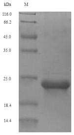 Recombinant Human Type-2 Angiotensin Ii Receptor (AGTR2) Protein (His-SUMO)