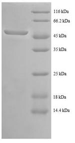 Recombinant Human Tyrosine-Protein Kinase Abl1 (ABL1) Protein (GST)