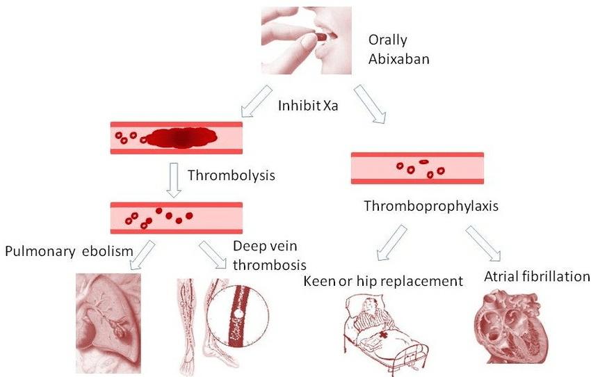 Clinical-application-of-apixaban-The-application-of-apixaban-in-the-treatment-of-venous