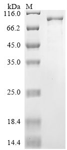 Recombinant Severe acute respiratory syndrome coronavirus 2 Replicase polyprotein 1ab (rep)