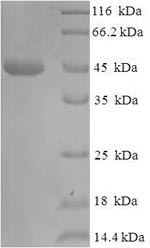 Recombinant Escherichia coli Beta-lactamase TEM (bla)