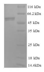 Recombinant Human Cytochrome c1, heme protein, mitochondrial (CYC1)