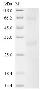 Recombinant Human Melanocortin receptor 4 (MC4R)
