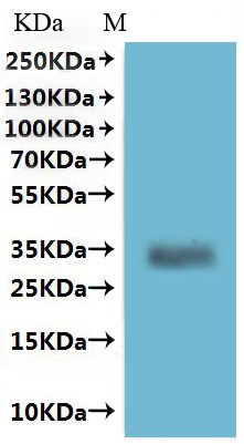 Recombinant Human Melanocyte-stimulating hormone receptor (MC1R)-VLPs