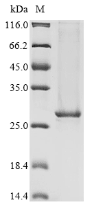 Recombinant Human Tyrosine-protein kinase BTK (BTK), partial