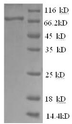 Recombinant Human Tyrosine-protein kinase BTK (BTK)