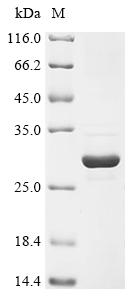 Recombinant Human Phosphatidylinositol 4,5-bisphosphate 3-kinase catalytic subunit alpha isoform (PIK3CA), partial