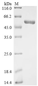 Biotinylated Recombinant Human Delta-Like Protein 3 (DLL3) Protein (MBP&His)