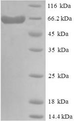 Recombinant Human Delta-Like Protein 3 (DLL3) Protein (His-SUMO)