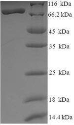 Recombinant Human Histone Deacetylase 1 (HDAC1) Protein (His-SUMO)
