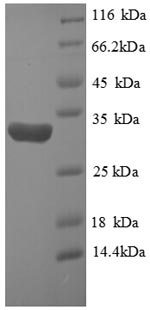 Recombinant Human Hypoxia-Inducible Factor 1-Alpha (HIF1A) Protein (His)
