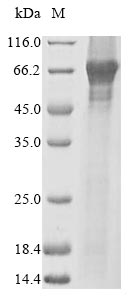 Recombinant Human Peroxisome Proliferator-Activated Receptor Alpha (PPARA) Protein (His&Myc)