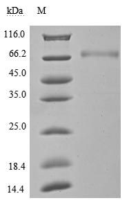 Recombinant Human Programmed Cell Death 1 Ligand 1 (CD274) Protein (hFc), Active